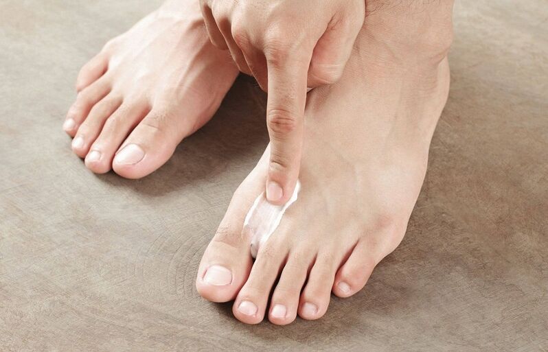 unguent pentru tratamentul ciupercii unghiilor de la picioare