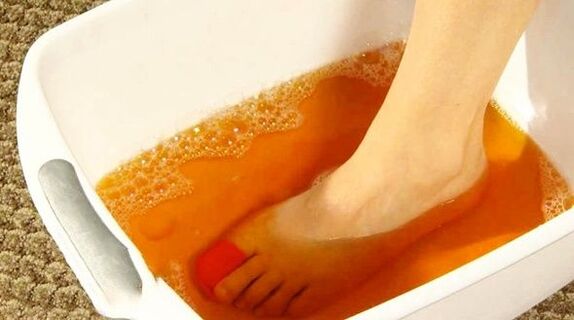baie cu iod împotriva ciupercii picioarelor