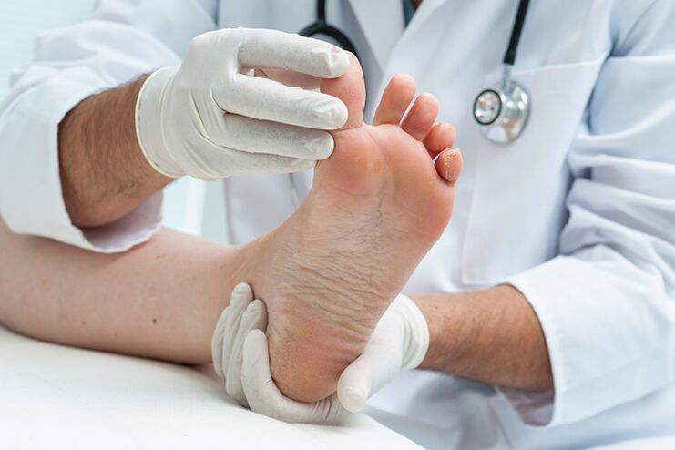 Dermatologul examinează picioarele pacientului